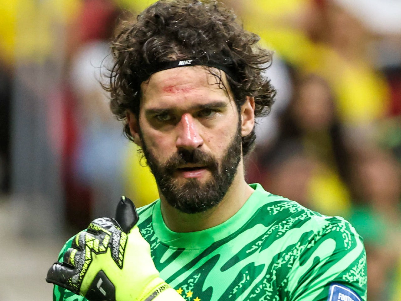 Alisson Becker, arquero de la selección brasileña de futbol tiene conmoción cerebral